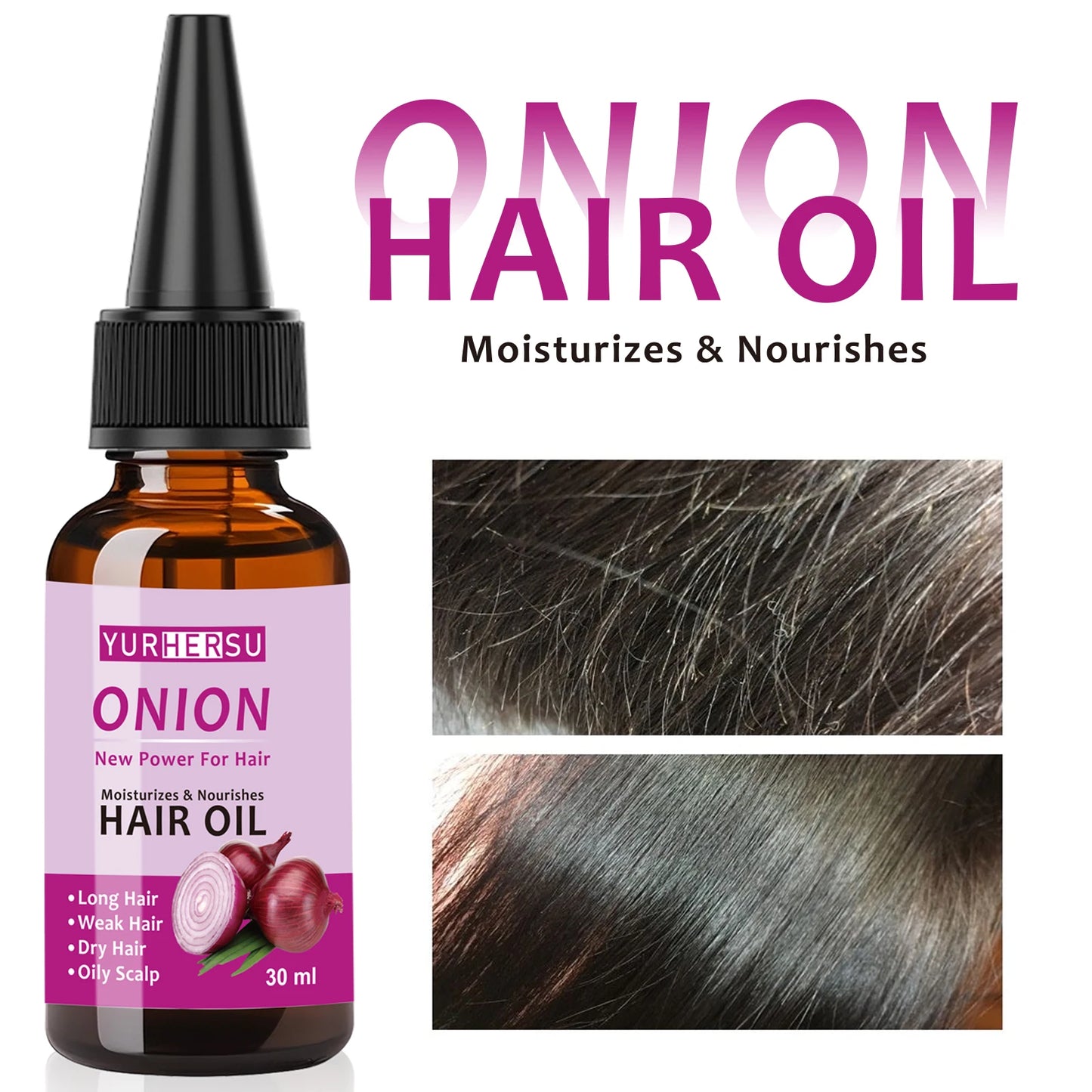 Onion Hair Oil for Growth, Stops Baldness, Promotes Healthy & Shiny Hair, 100% Pure Natural Hair Care Treatment